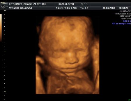 2�me �chographie